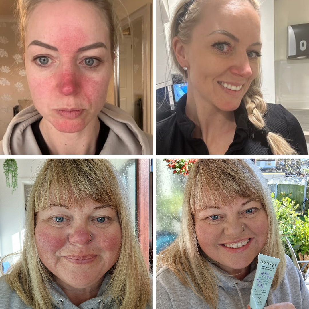 Rosalique 3 in 1 Anti-Redness Miracle Formula SPF50