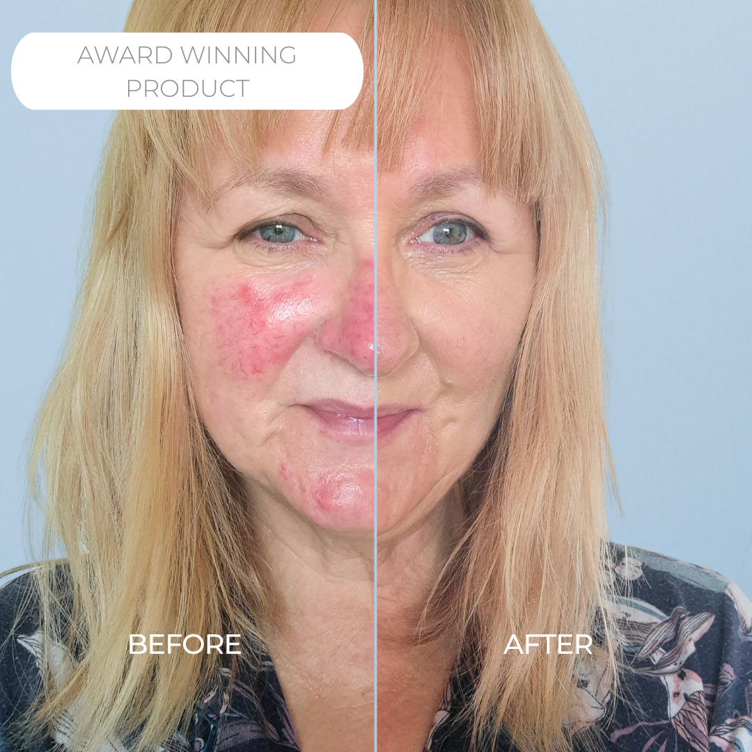 Rosalique 3 in 1 Anti-Redness Miracle Formula SPF50 Sample 3ml