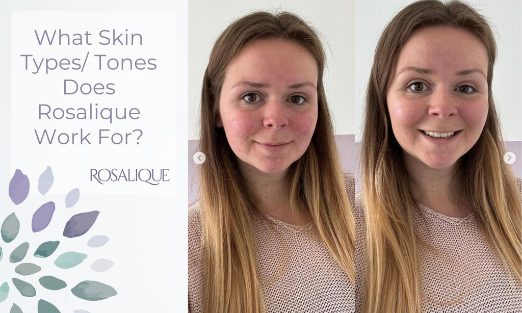 What kinds of skin types or tones is Rosalique 3 in 1 Miracle Formula for?