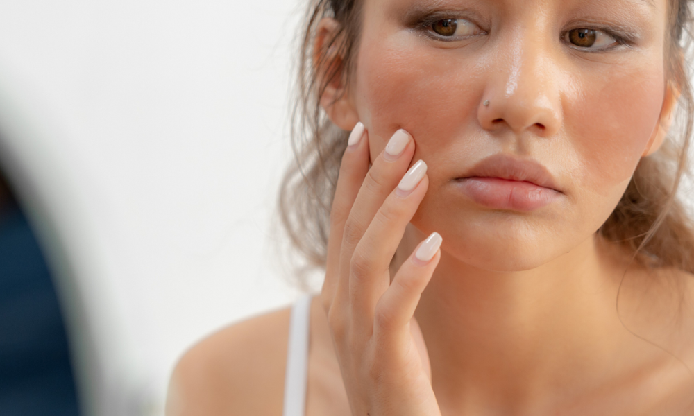 Let your food be your rosacea-remedy