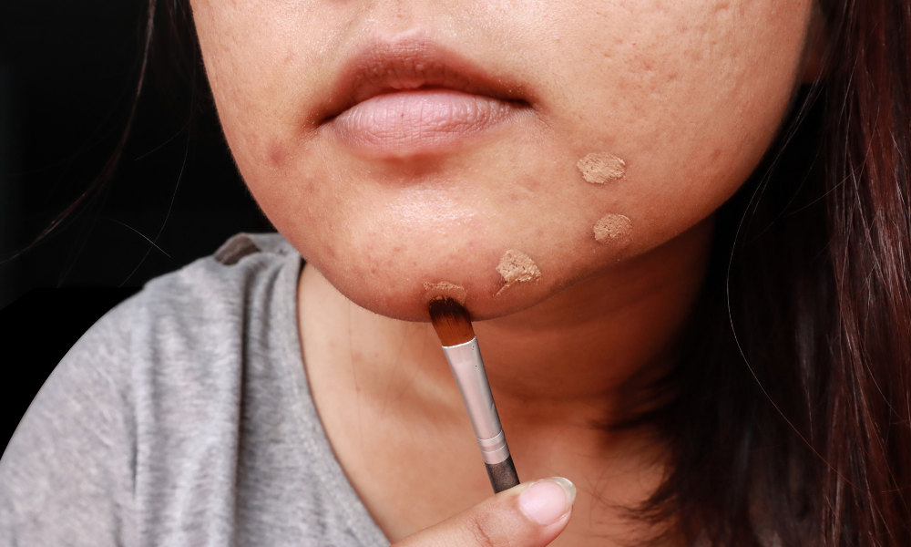 Make-up Tips for Eczema Sufferers