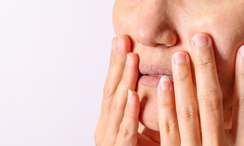 FAQs - Eczema and Rosalique