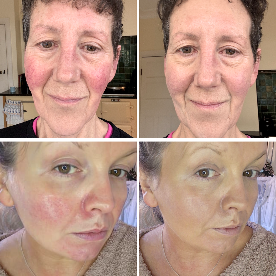 The Morning Collection