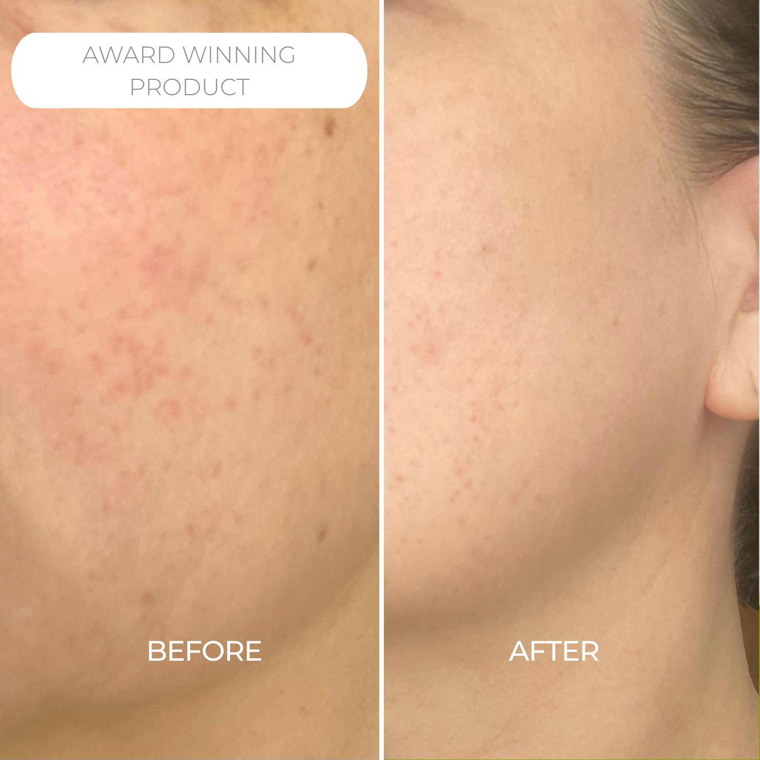 Creams Set - FREE Miracle Formula